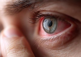 Siete pesadillas oftalmológicas por usar lentillas y toda la parafernalia del terror en Halloween