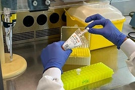 Imagen facilitada por el CSIC del test genético de la muestra de sangre.