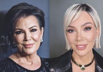 ¿Qué es el 'Deep Plane'? La cirugía que todos quieren... pero solo pueden pagar las Kardashian