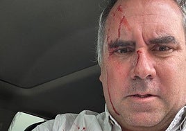 Rafael Belaúnde, con manchas de sangre.