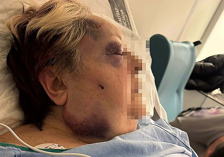 Agresión salvaje a una mujer de 71 años en Valencia por parte de dos jóvenes para robarle
