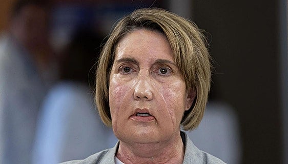 Las 25 horas que devolvieron la cara a Carme