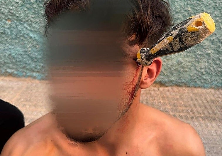 Clavan un destornillador en la cabeza a un hombre durante una violenta pelea en Alicante