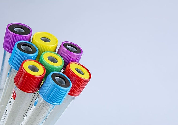 Descubren que el glutatión es un combustible para las células tumorales