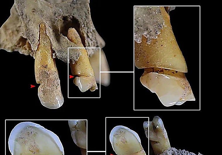 Una dentadura de hace 4.000 años hallada en Andalucía demuestra la división sexual del trabajo