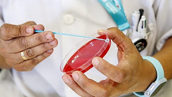 Tres perfiles de pacientes podrían mejorar la detección y prevención de la hepatitis C y las ITS en hombres con VIH