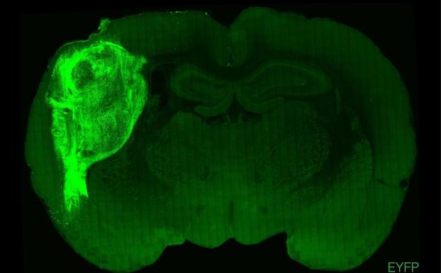 Organoide humano -a la izquierda, fluorescente- en un cerebro de rata. 