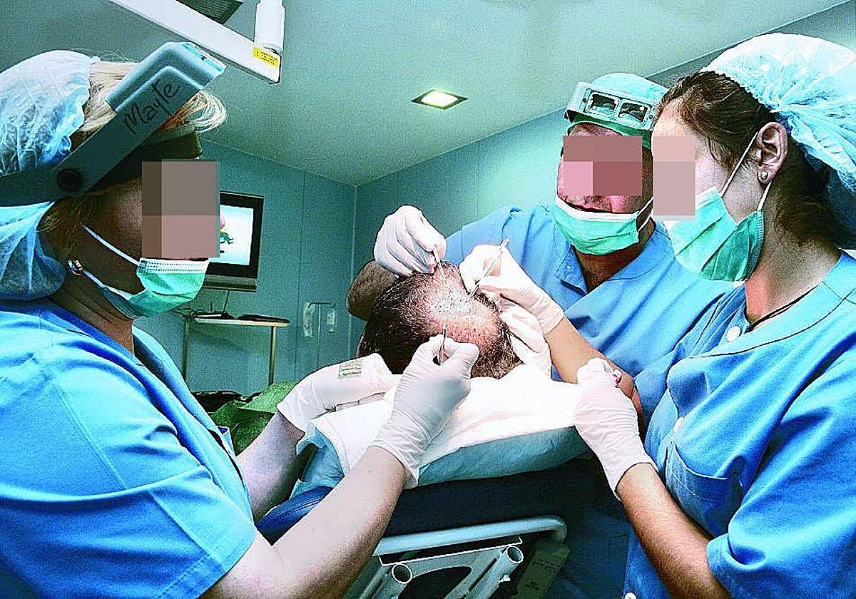 Imagen de archivo de un implante capilar.