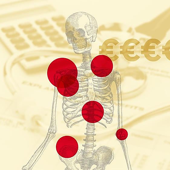 El coste de frenar la lista de espera de Salamanca: hasta 6.000 euros por una cadera en la privada