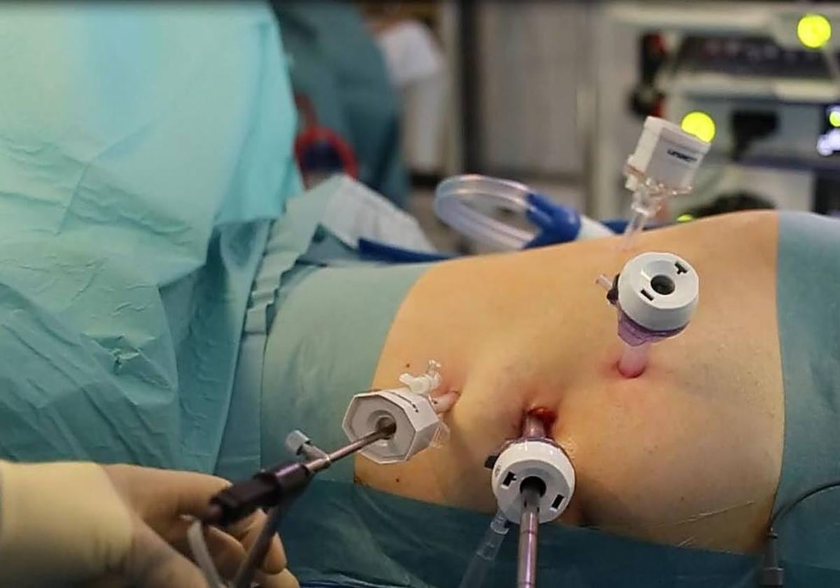 Foto de archivo de una intervención en el Hospital de Salamanca