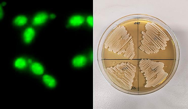 Cepa de estudio C. albicans en placa.