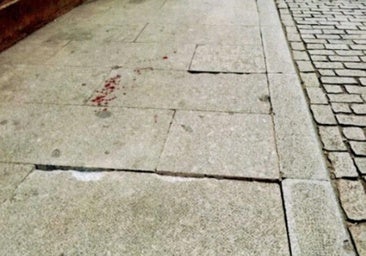 El ayuntamiento reparte culpas con una mujer que se rompió el brazo en una acera y le paga 1.400 euros
