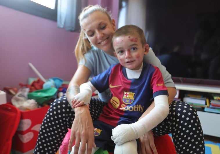 Javi, niño con piel de mariposa en Salamanca, junto a su madre