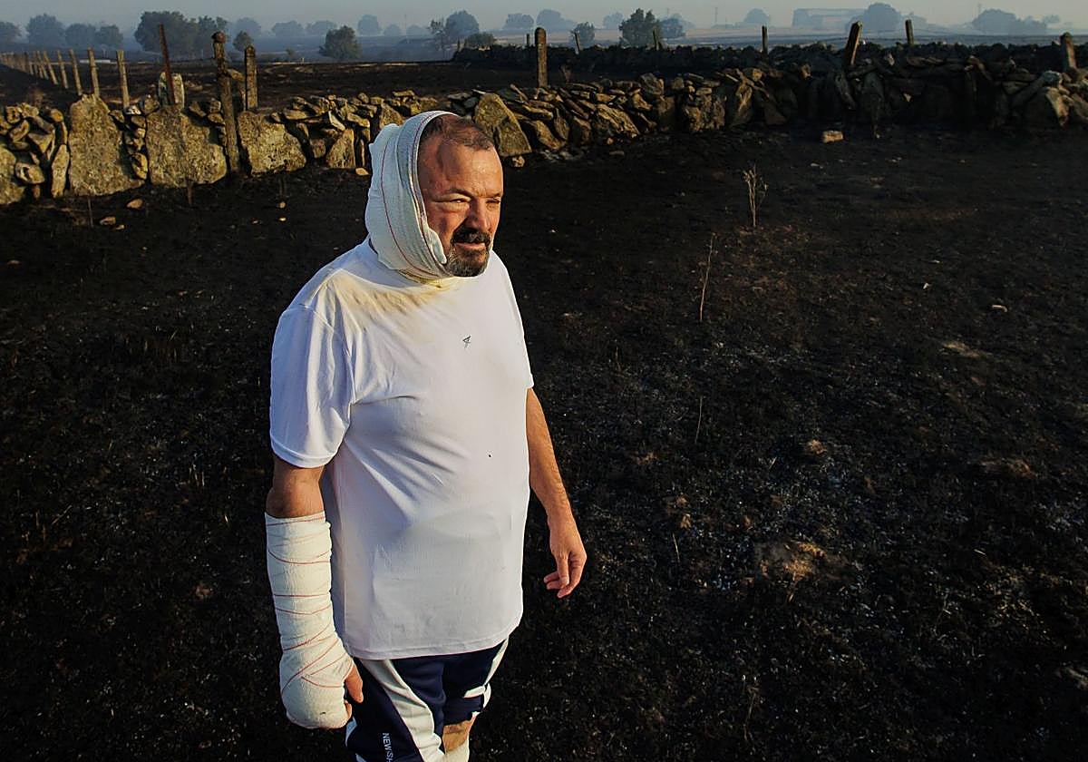 José Manuel Blanco, vecino de Cipérez herido en el incendio de este viernes.