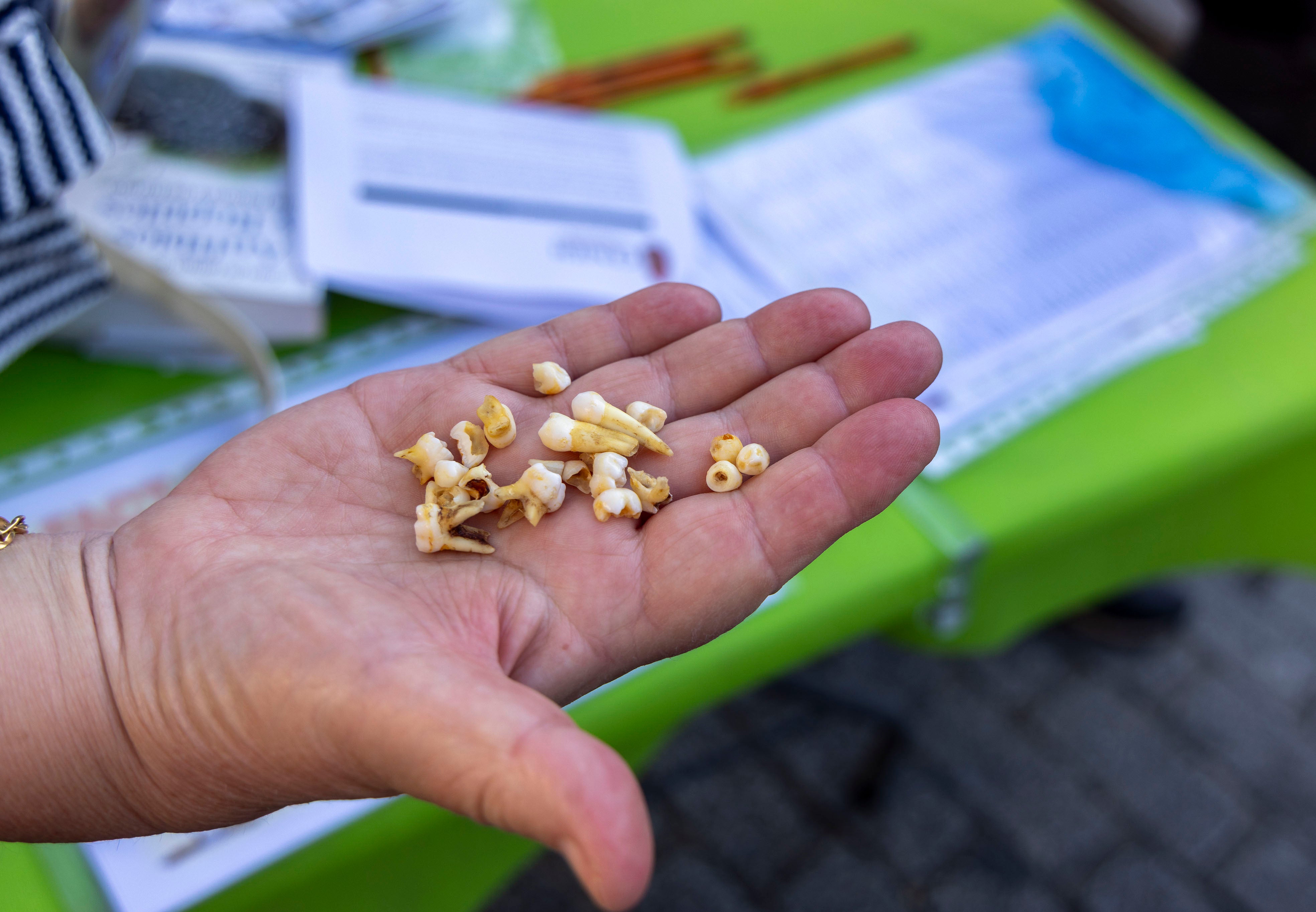 Cuando el Ratón Pérez se convierte en científico: los dientes de leche de Salamanca ya hablan en los laboratorios