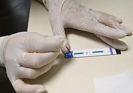 HIV kann mittlerweile mithilfe von Teststreifen nachgewiesen/ausgeschlossen werden.