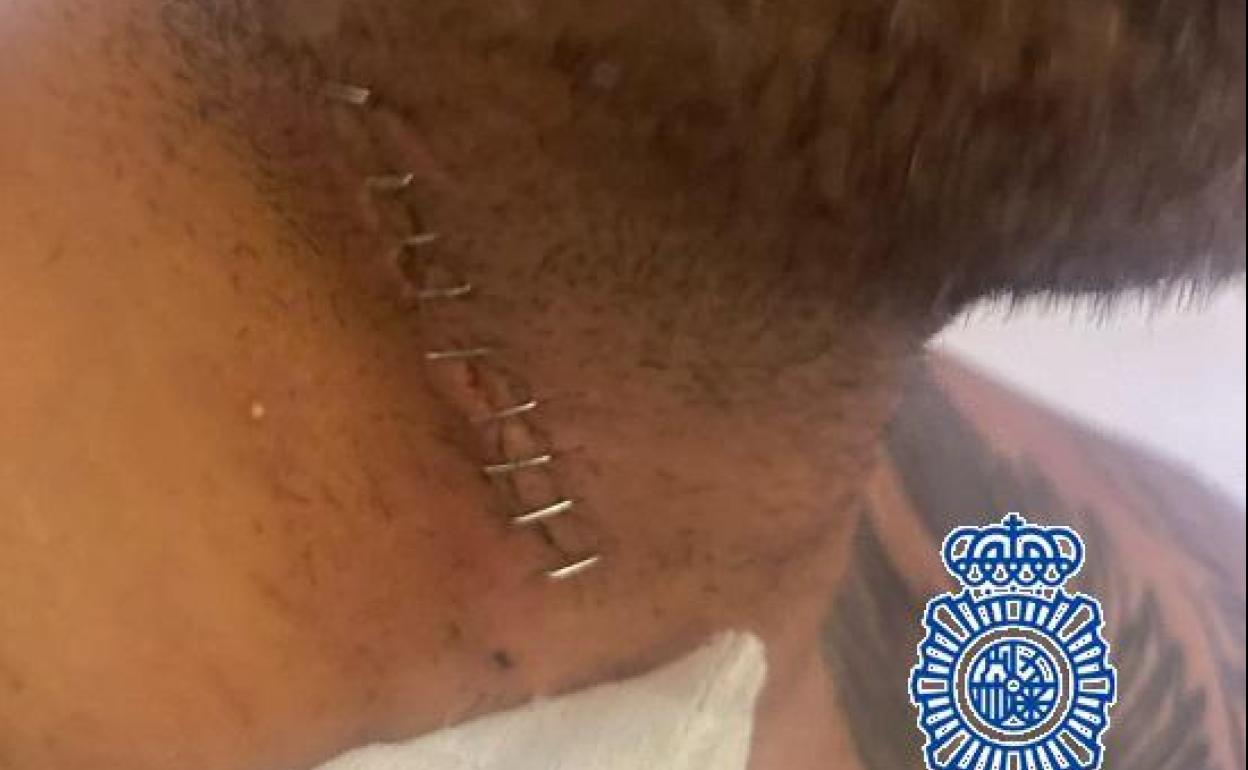 Well-known 'influencer' arrested for stabbing a man in the throat in Estepona