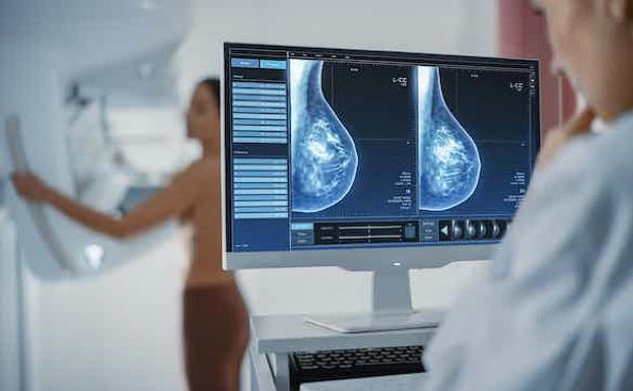 Oncologists recommend a mammogram every year or two. 