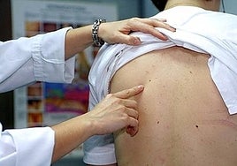 Melanoma is the most dangerous type of skin cancer.