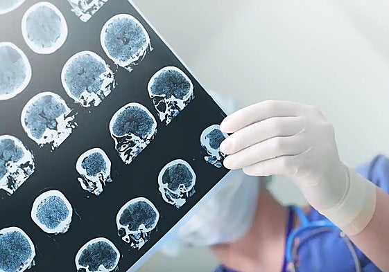 Treatment for epilepsy has significantly improved over the years.