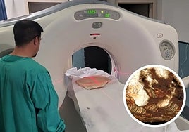 The scanning of part of a rare stegamite.