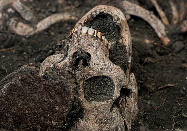 Previous image of the same body that has been desecrated, showing the gold teeth.