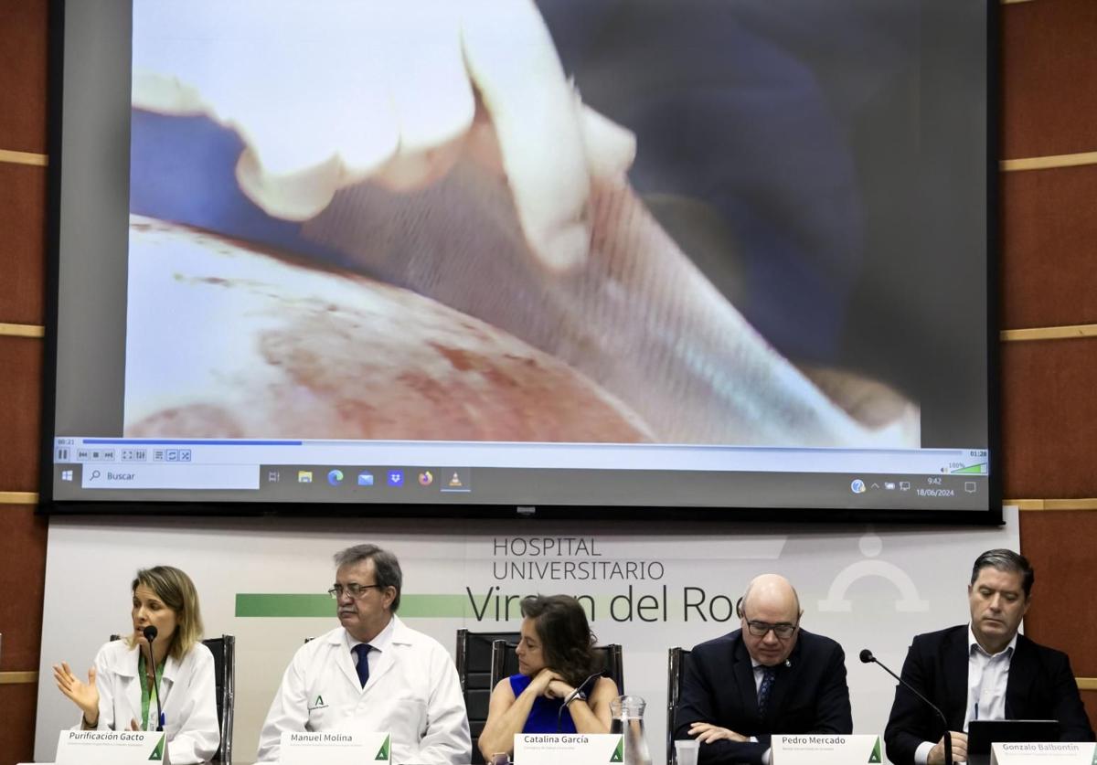 Virgen del Rocío hospital in Seville the first in Spain to get authorisation for use of artificial human skin