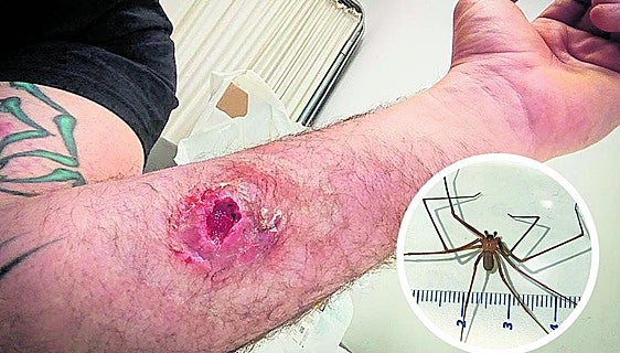 Poisonous 'violin spider' bites man in Spain's Basque Country