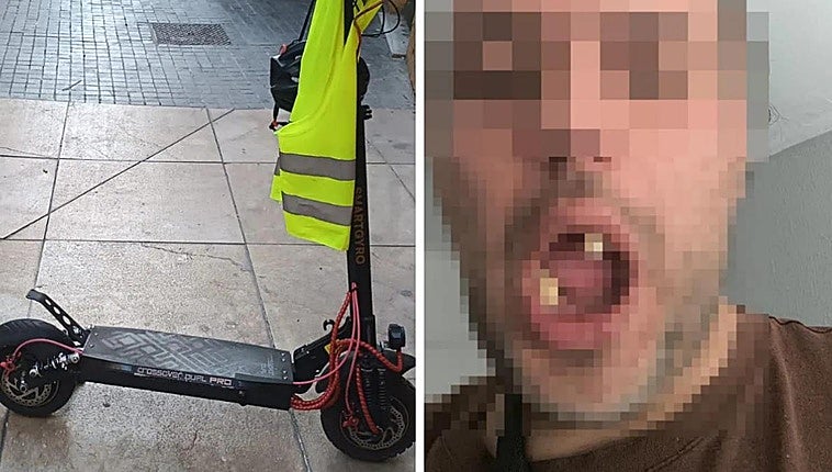 Man loses eight teeth after thieves knock him unconscious and steal his electric scooter in Malaga