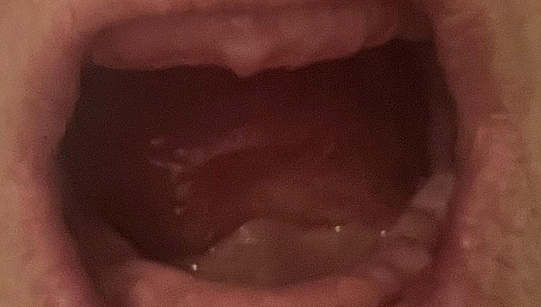 Victim of the dentist arrested in Malaga: 'He left me without teeth and the face of an old woman'