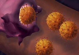 Melanoma cells under the microscope.