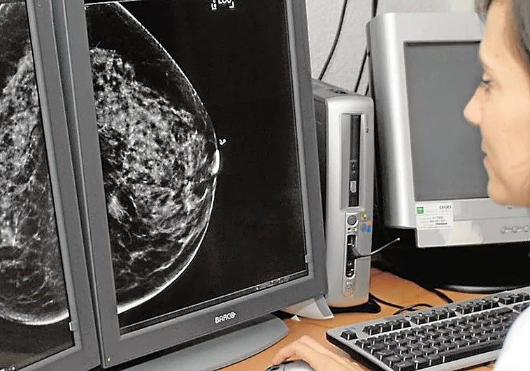 Medical professional examines a mammogram.