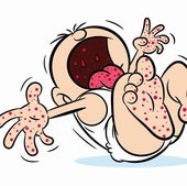 What is hand, foot and mouth disease, the infection that empties nurseries every autumn?