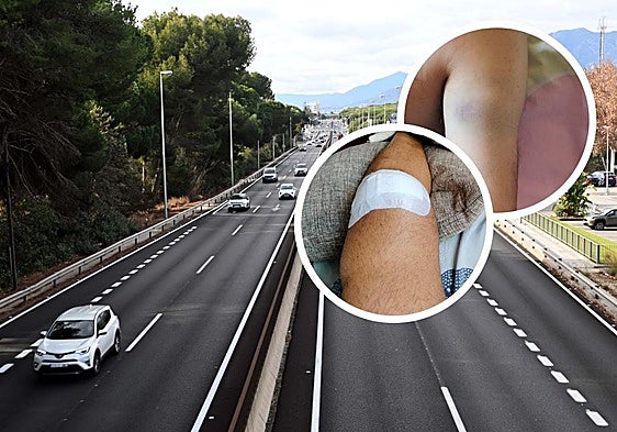 Biker appeals for help to track down lorry driver who left scene of accident on A-7 in Marbella