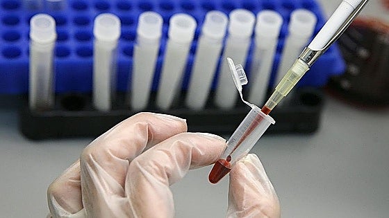 Malaga needs more bone marrow donors: numbers have fallen by 28.3% in one year