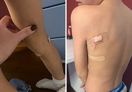 Photos of the injuries sustained by the nine-year-old boy.