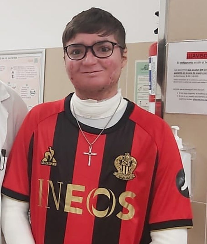 Imagen secundaria 2 - Some of the more than 80 wounds that Adrián has over his body as a result of the disease.