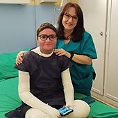 Adrián, a young man from Tolox with butterfly skin disease, with his mother, Virginia Cortés.