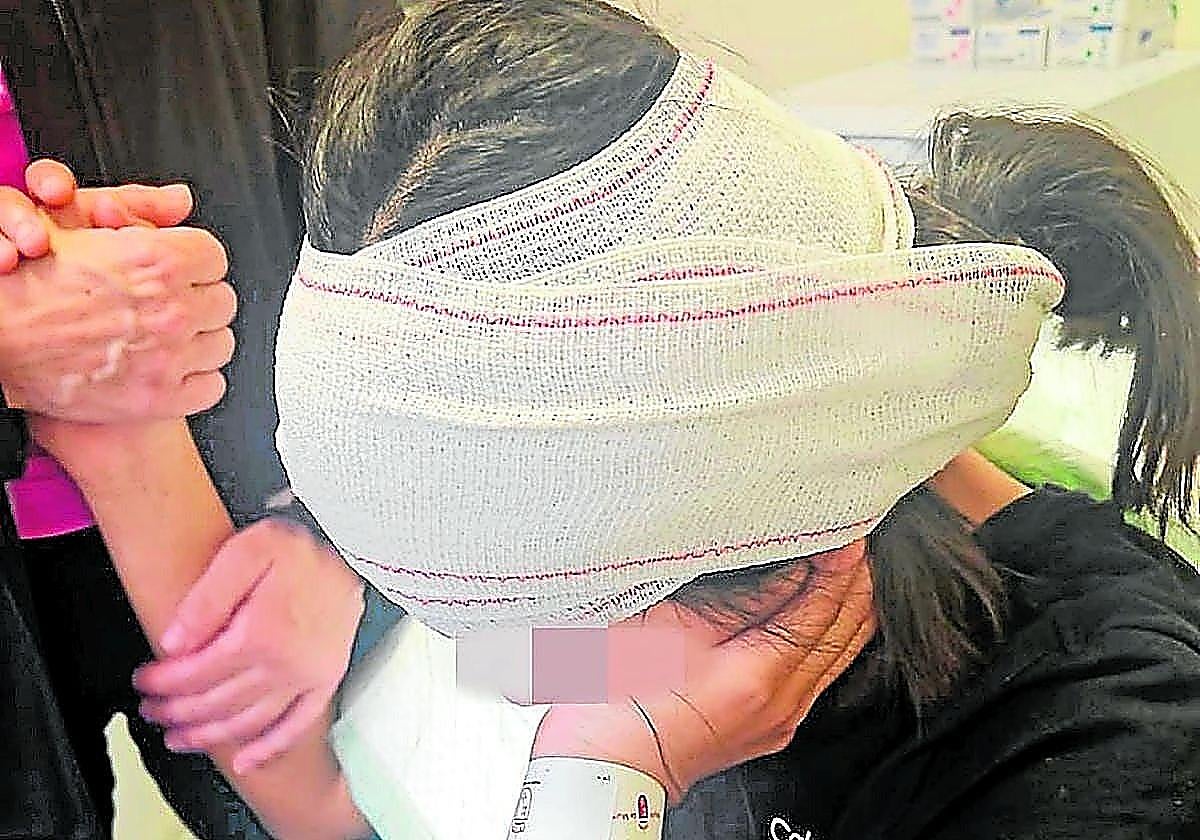 School violence in Spain: Girl fears returning to class after student bites part of her ear off