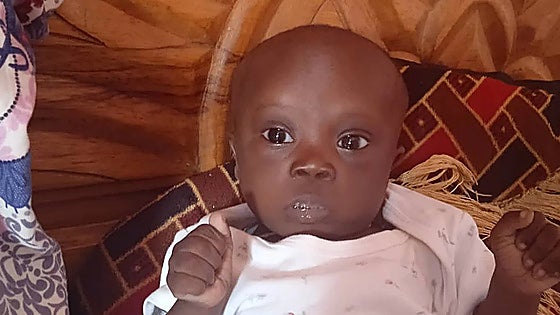 Malaga's Hospital Materno successfully performs heart surgery on Senegalese boy with Down syndrome