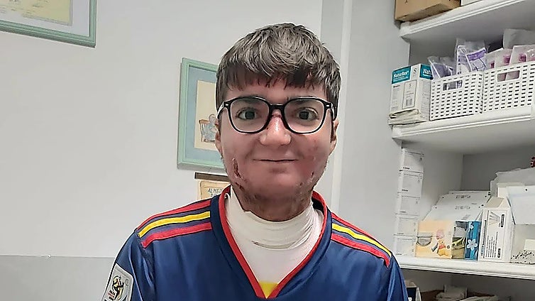 Malaga: young man becomes first in Spain to receive gene therapy for 'butterfly skin'
