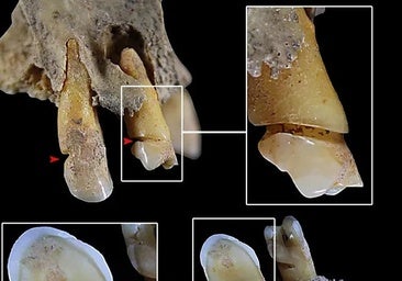 Samples in which the gedndered component of the work has been detected.