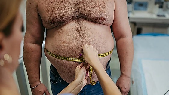 Malaga cardiologist stresses the importance of waist measurements in assessing heart attack risks