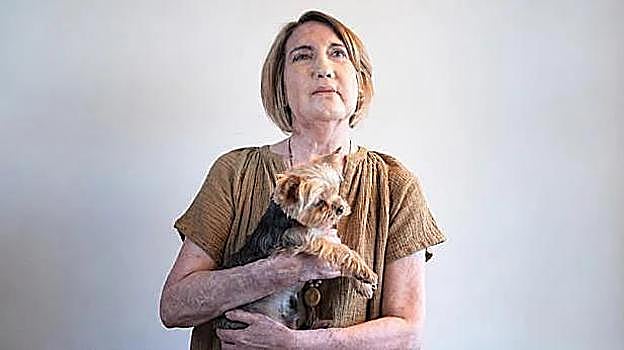 Imagen después - Carmen in the Canaries, in July 2024, just before she suffered the spider bite that developed into necrotising fascitis. On the right, a recent photo taken in her home, with her dog Coco.