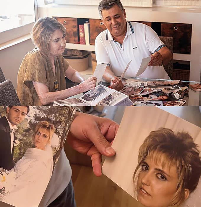 Carmen and her husband, Carlos, browse through family albums filled with photos taken before the operation