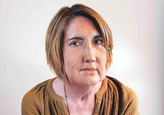 Carmen’s life after a face transplant: ‘I recognise myself by my eyes’