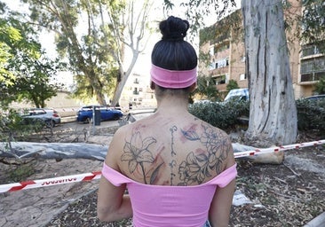 Sheila, one of the victims that the fallen tree branch in Malaga injured, showing the scars on her back.