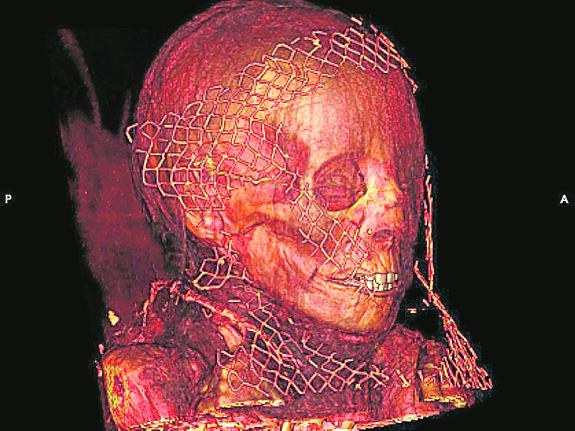 An image of one of the analysed mummies, generated thanks to the use of a scanner.
