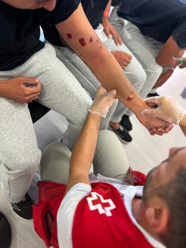 Quemaduras corrosivas provocadas por el combustible y agua salada.