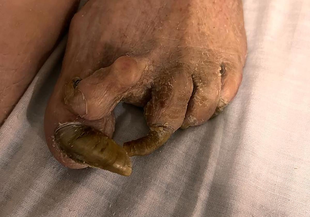 Imagen principal - Algunas de las imágenes denunciadas por Recova.